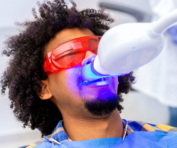 Arlington Teeth Whitening